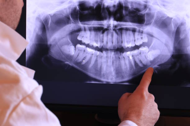 Best Orthodontic Emergency Dentist in Oakhurst, CA